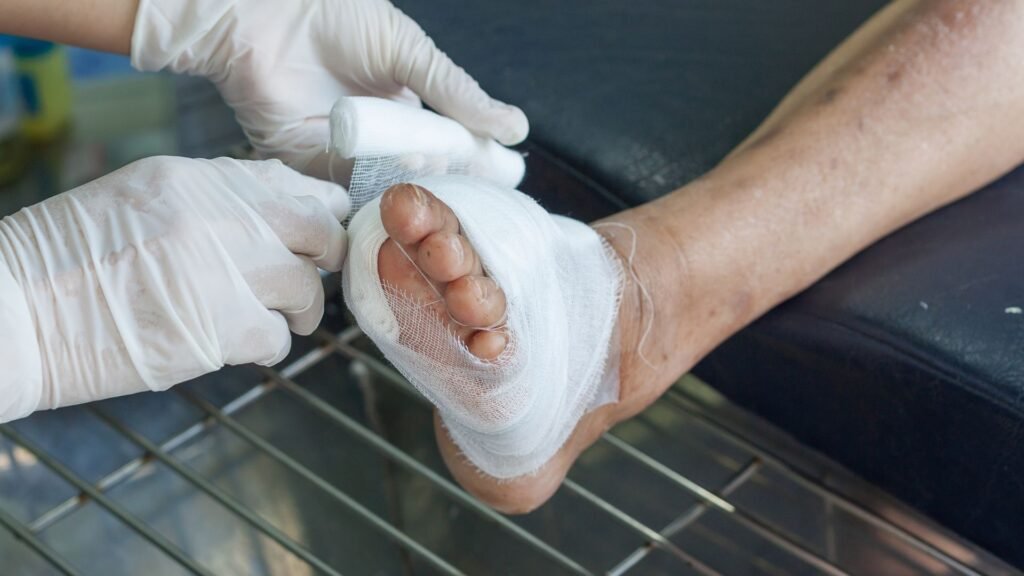 diabetes and foot ulcer