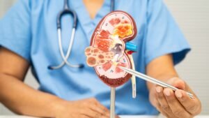 Blog Posts 3 Kidney Disease Study